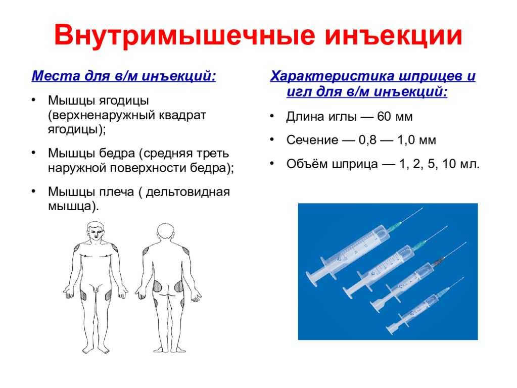 Приснился укол шприцом в руку. сонник укол, к чему снится укол
