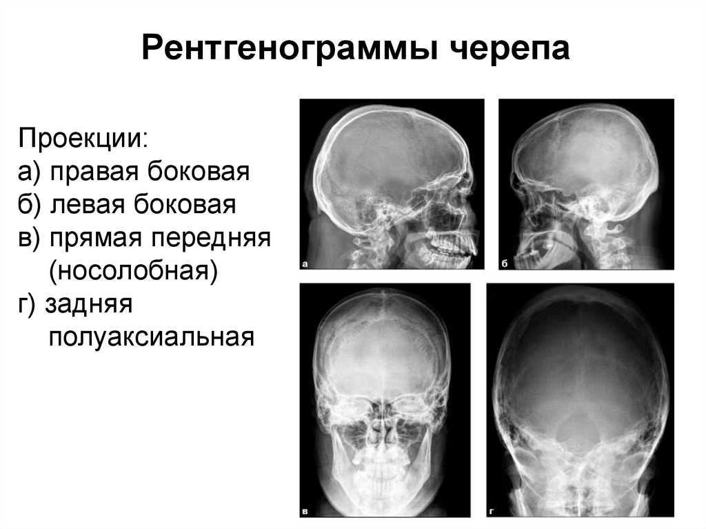 Делать рентген зубов
