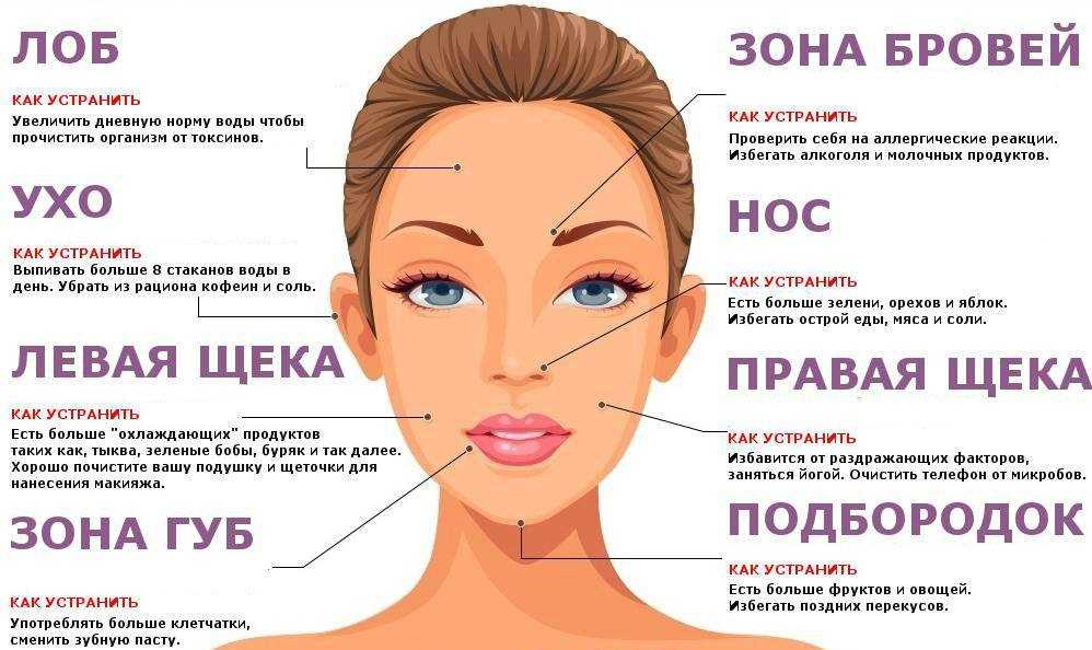 К чему снятся прыщи - значение сна прыщи по соннику