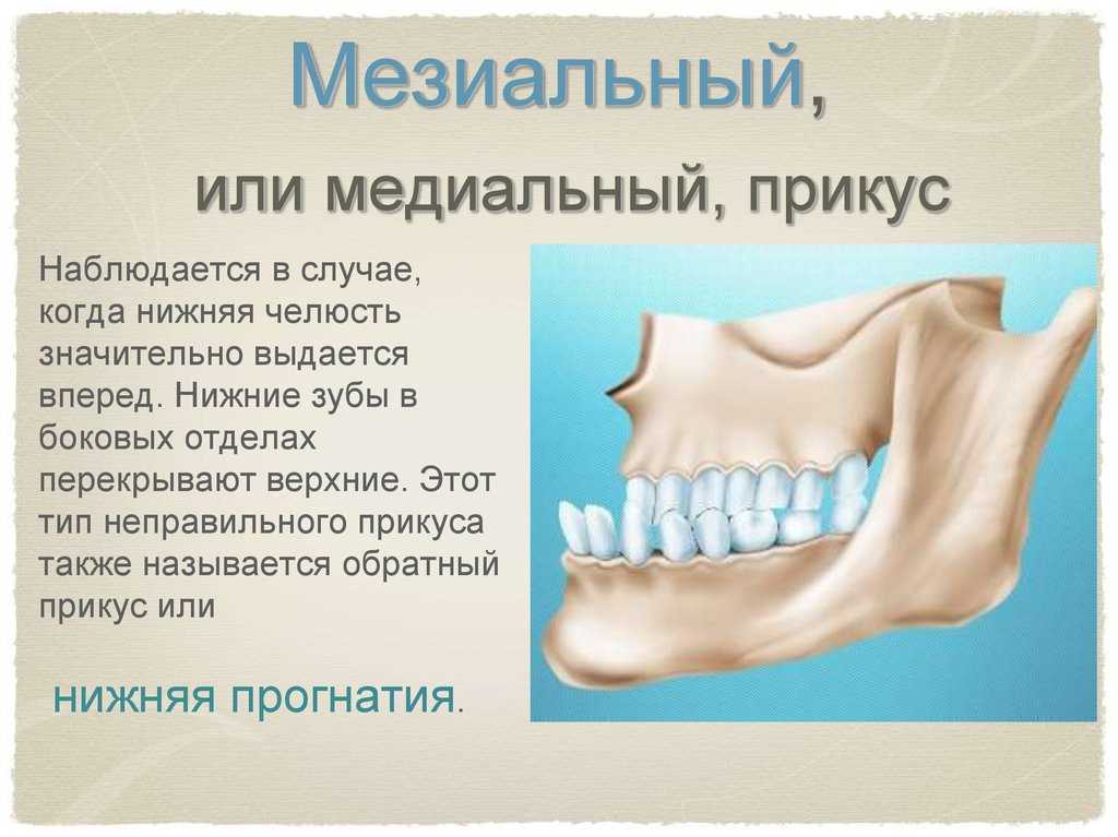 Сонник — челюсть