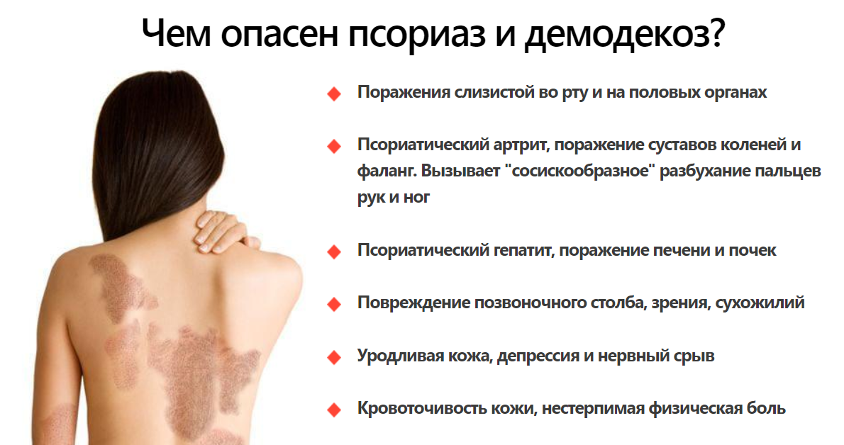К чему снится лишай