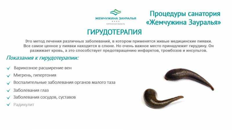 Как расшифровать сон о пиявках — 39 точных значения