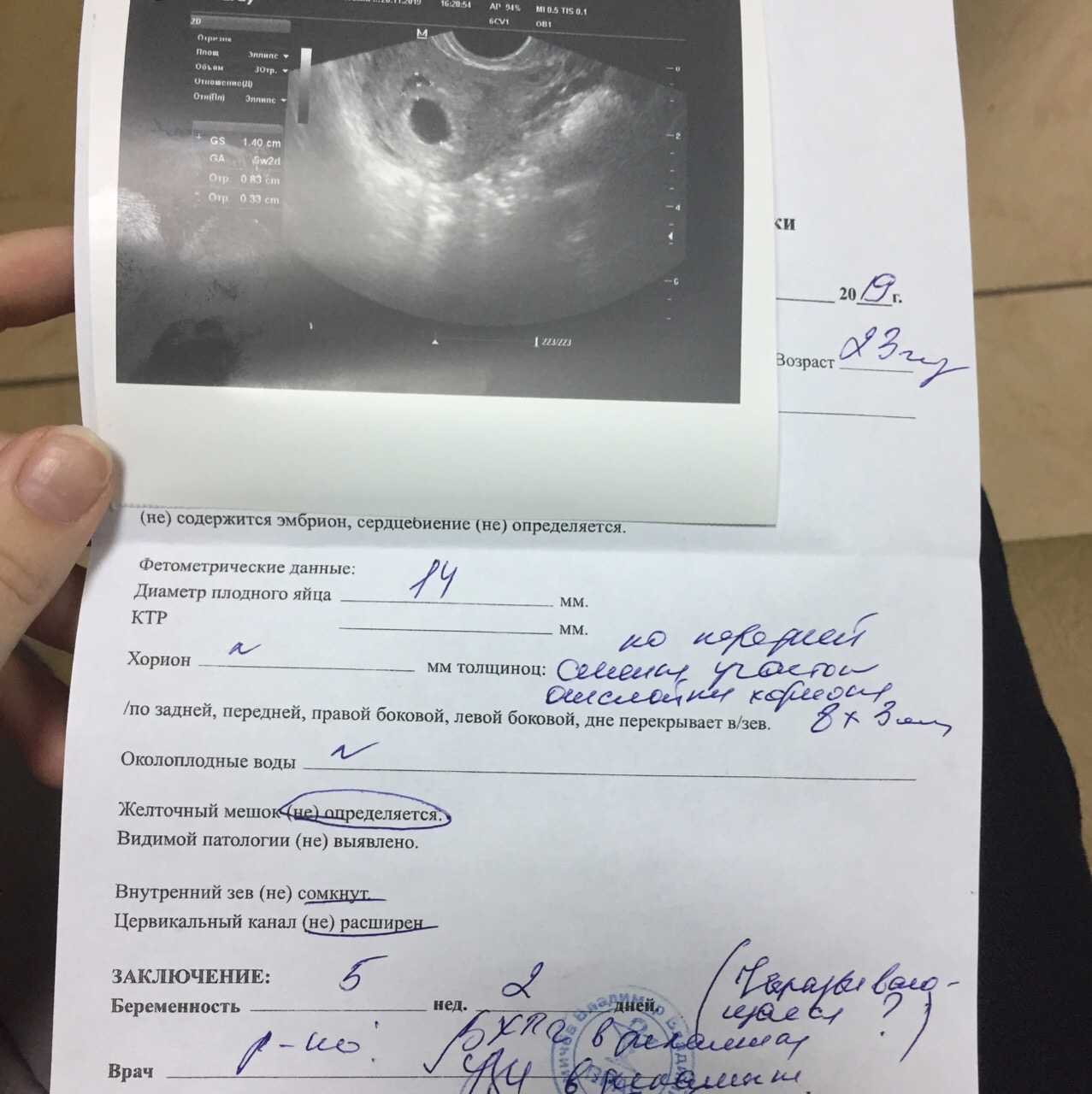 Приснился сон узи 100 не беременна. cонник узи, к чему снится узи во сне видеть. к чему снится плохое узи