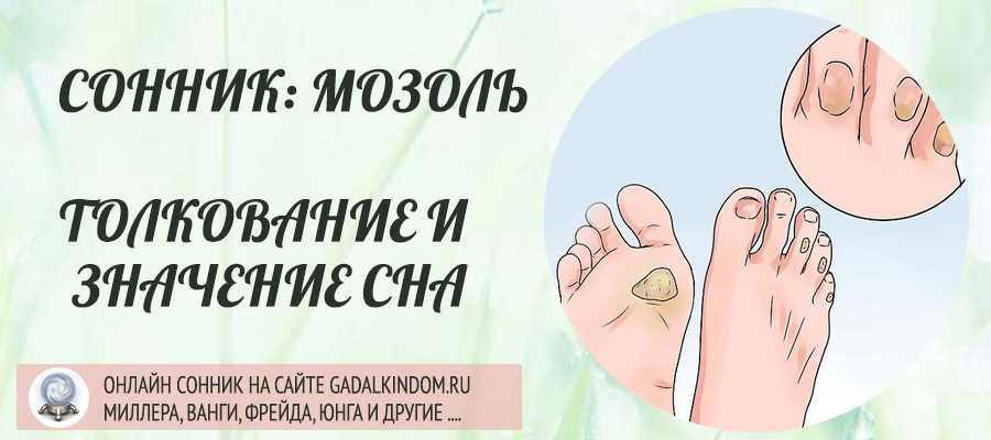 К чему снятся мозоли на ногах: выбор сонника, значение и толкование сна - tolksnov.ru
