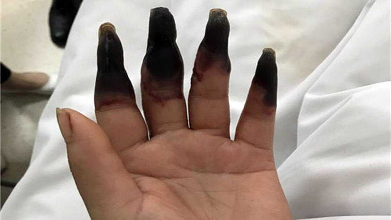 К чему снятся волосатые руки - трактование для женщины