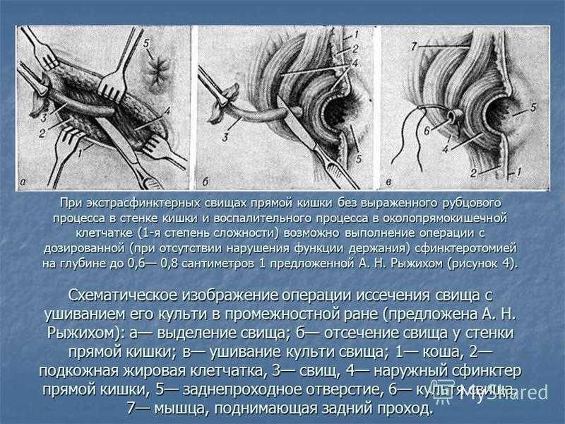 К чему снится гной? сонник: рана с гноем, выдавливать гной на лице. толкование снов - tolksnov.ru