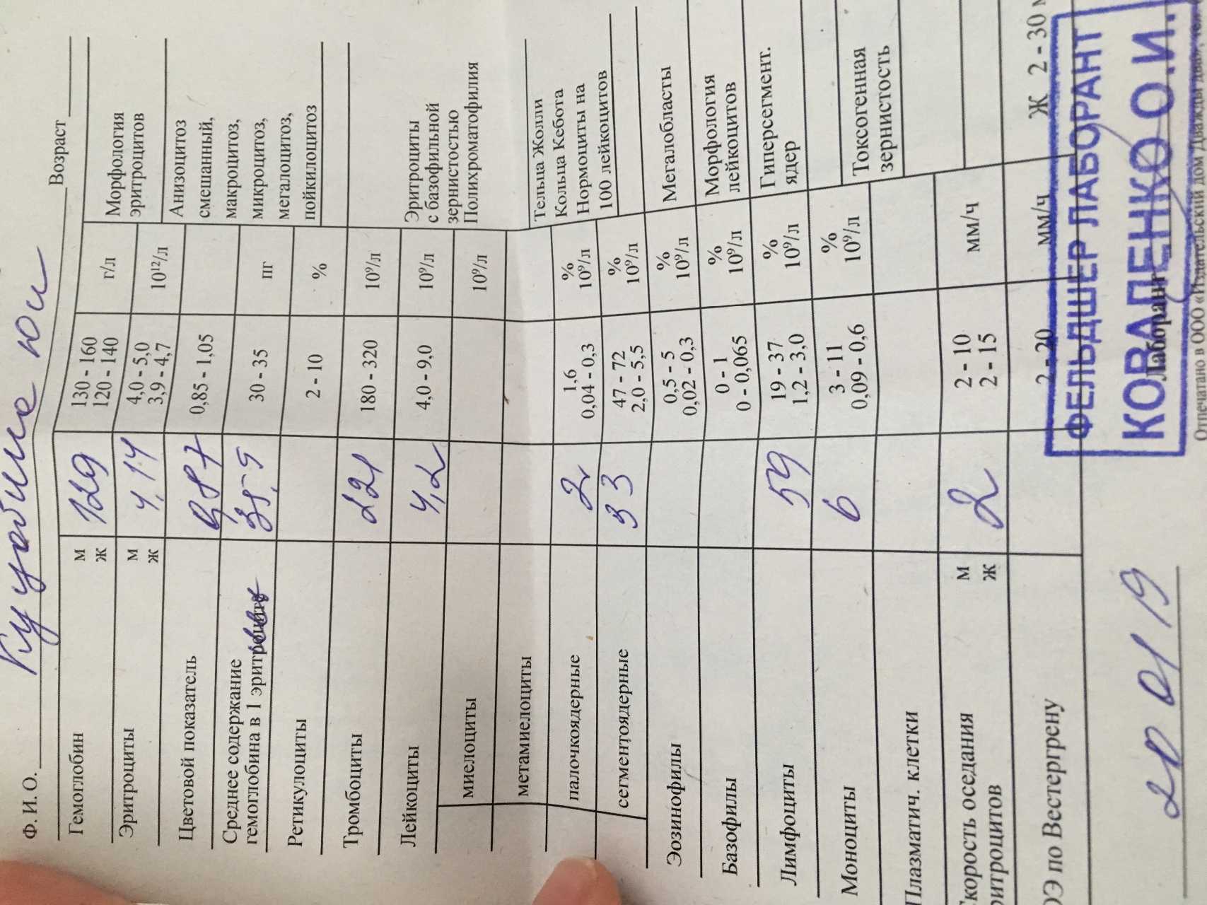 К чему снится говно - увидеть собственные испражнения