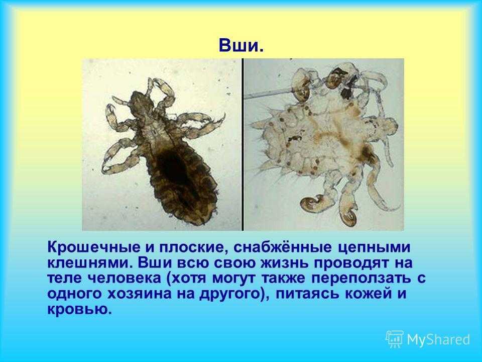 К чему снятся жуки в волосах на сайте сонник гуру