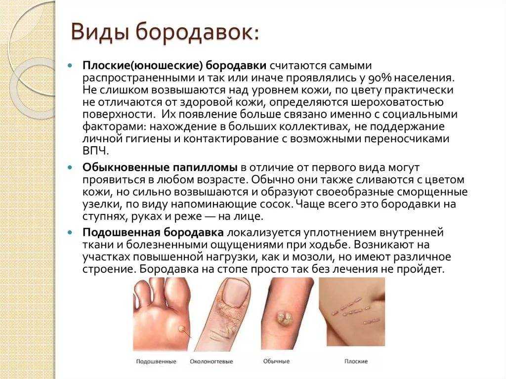 Сонник: приснились бородавки на лице, руках и других частях тела