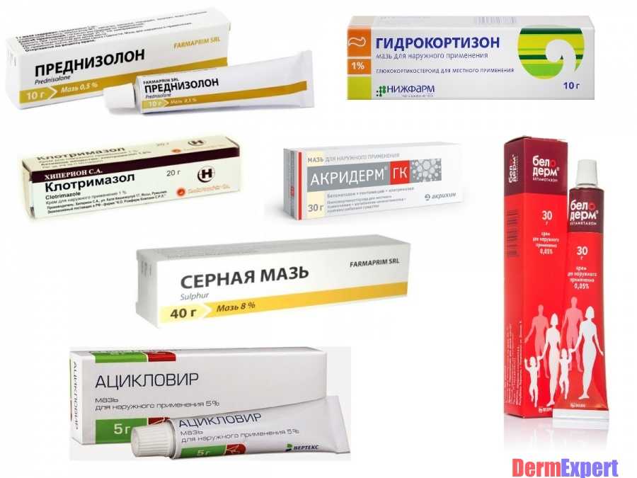 Заговор от лишая – читать на себя и ребенка