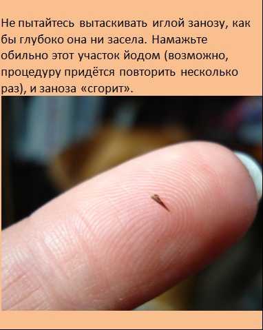 Сонник заноза в глазу. к чему снится заноза в глазу видеть во сне - сонник дома солнца