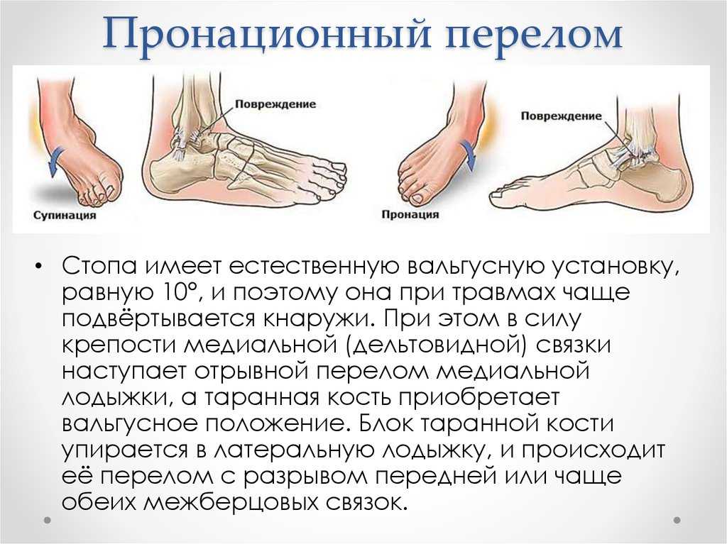 Сонник доставать осколки стекла из себя