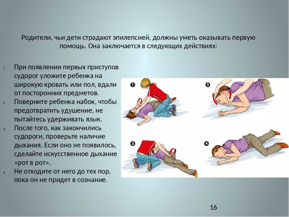 К чему снится приступ эпилепсии. припадок эпилепсии