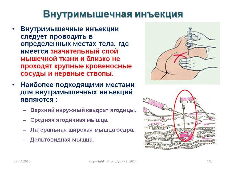 Сонник уколы в шею | сонник