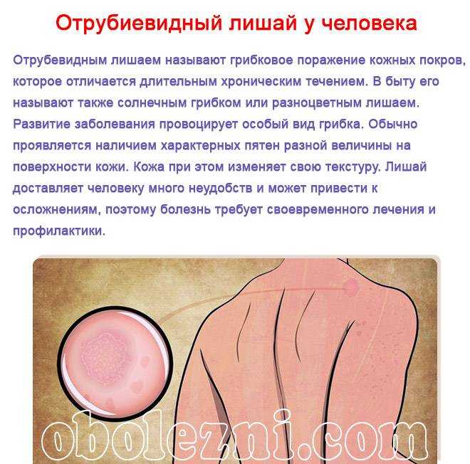 Может ли быть лишай порчей | портал чёрной магии