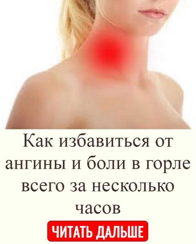 Молитва от ангины
