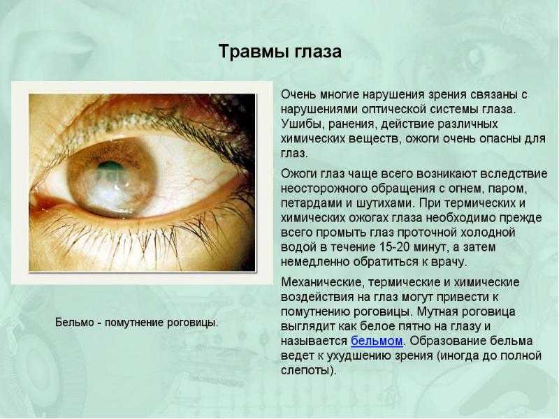 Приснился глаз с бельмом во сне. бельмо глазах