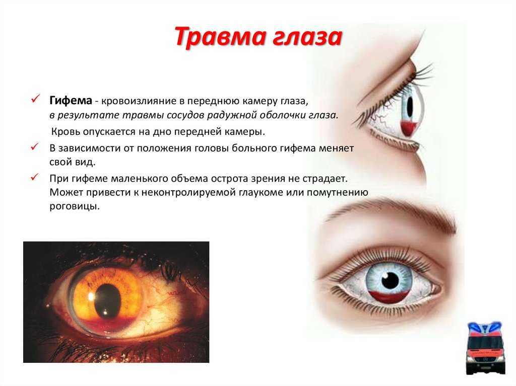К чему снятся глаза во сне