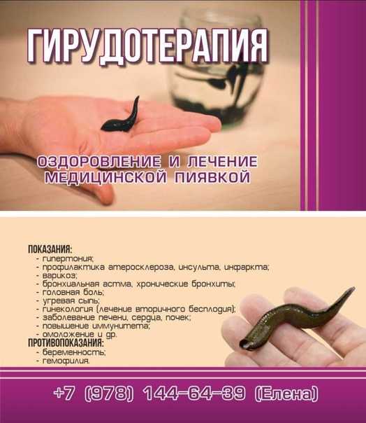 Сонник пиявка  приснилась, к чему снится пиявка во сне видеть?