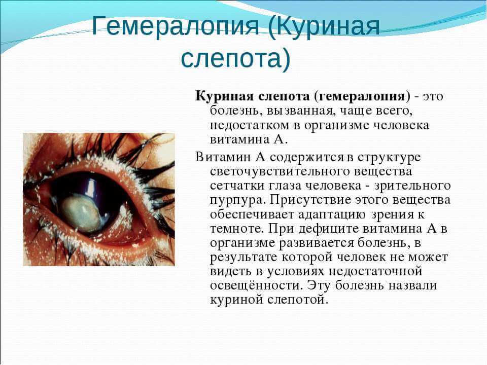 Приснился глаз с бельмом во сне. к чему снится бельмо во сне, сонник видеть бельмо что означает