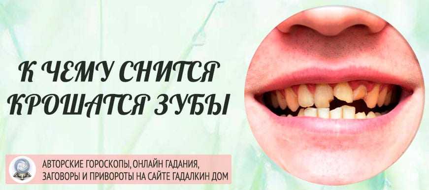 Сонник спала коронка с зуба. к чему снится спала коронка с зуба видеть во сне - сонник дома солнца