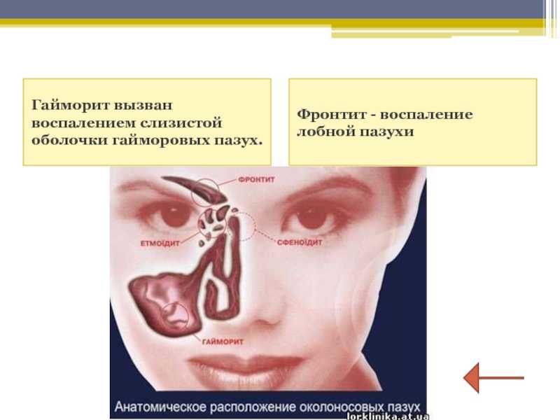 Самые эффективные заговоры от насморка для взрослых и детей