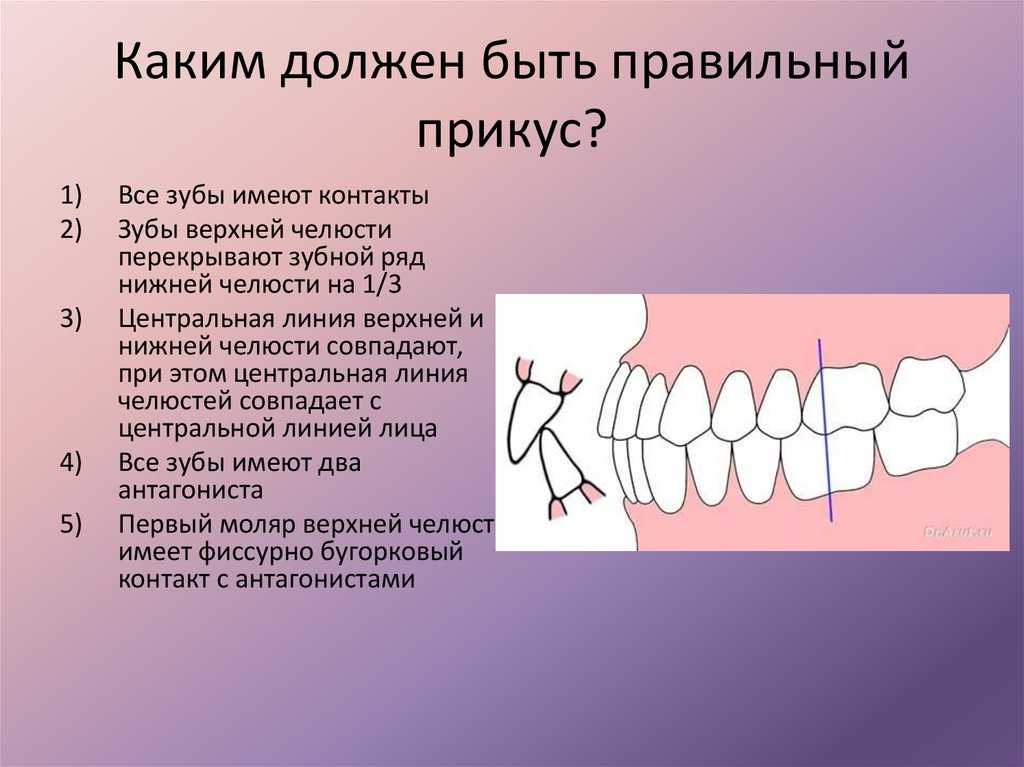 К чему снится что выпала вся челюсть