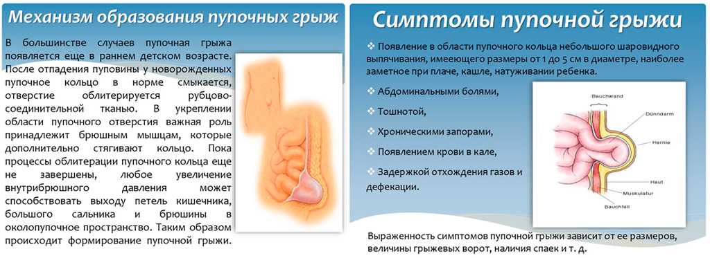 К чему снится гной